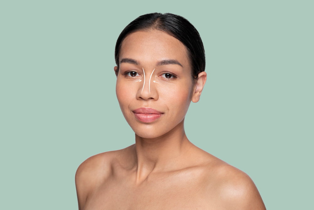 O que não pode comer depois de fazer rinoplastia? 2 preco rinoplastia